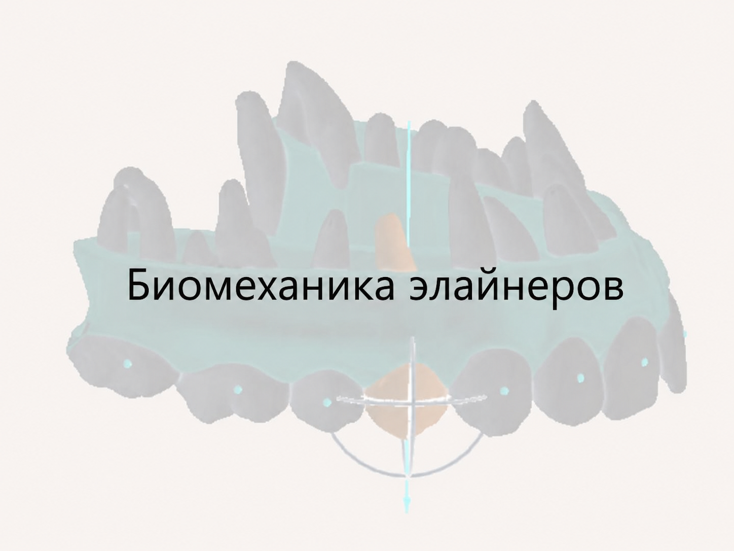 Блок 2 - Биомеханика элайнеров